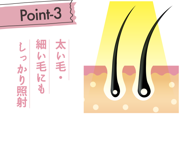 太い毛・細い毛にもしっかり照射