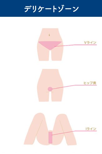 脱毛できるデリケートゾーン